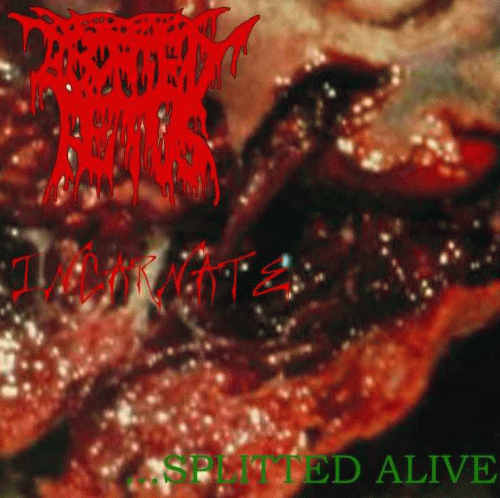 Aborted Fetus : Splitted Alive